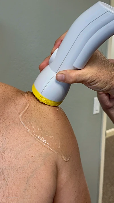 Chiropractic Phoenix AZ Shockwave Shoulder A patient receiving shockwave therapy on their shoulder
