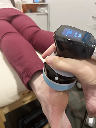 Softwave Therapy on Patient's Heel